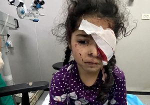 سازمان ملل متحد: حملات اسرائیل در غزه پاکسازی نژادی است